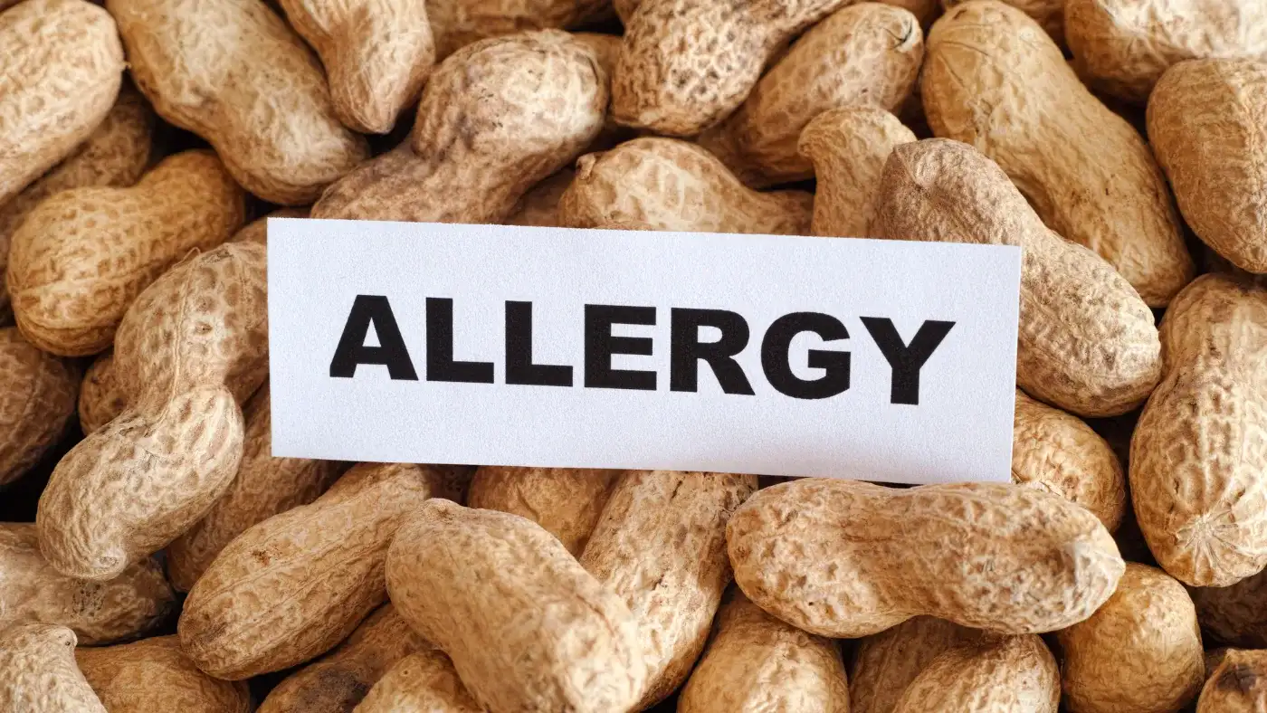 殻つきの落花生の上に、「ALLERGY」と書かれた白い紙が置かれている
